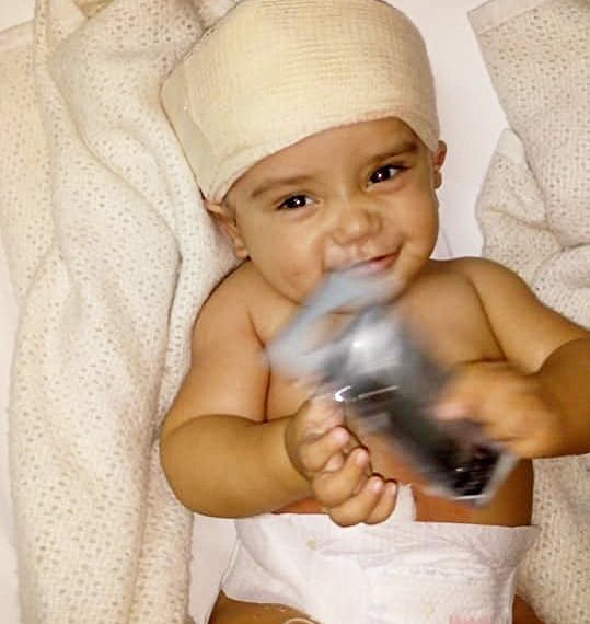 Un bebé de 10 meses necesita ayuda económica para una compleja cirugía