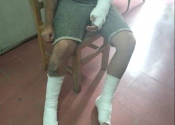 Un capataz arrojó al vacío a un albañil porque no le gustó cómo quedó la losa