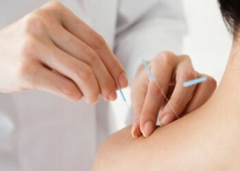 Habilitan a kinesiólogos y fisioterapeutas a utilizar una práctica milenaria de la medicina China